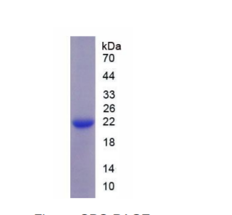 钠氯协同转运蛋白(NCCT)重组蛋白