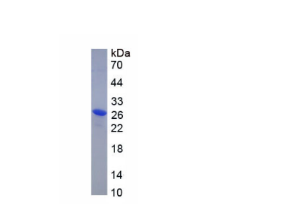 溶质载体家族26成员4(SLC26A4)重组蛋白