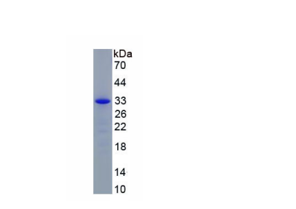 溶质载体家族30成员8(SLC30A8)重组蛋白铁转运蛋白(MFRN)重组蛋白