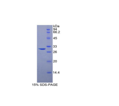 鞘氨醇激酶1(SPHK1)重组蛋白