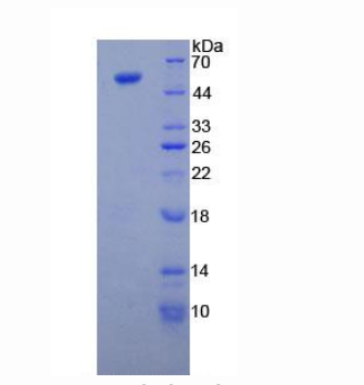 微管蛋白β3(TUBb3)重组蛋白