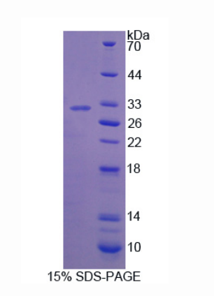 干扰素γ诱导蛋白30(IFI30)重组蛋白