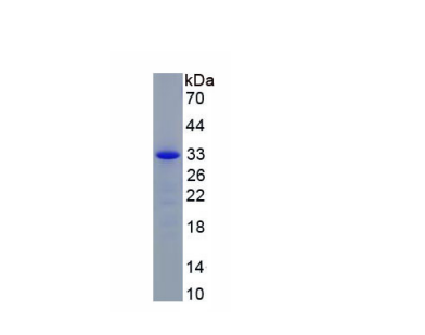 白介素22受体α2(IL22Ra2)重组蛋白