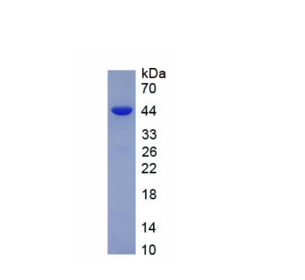 免疫球蛋白A1(IgA1)重组蛋白