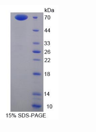 膜联蛋白A9(ANXA9)重组蛋白