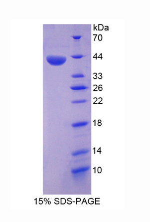 膜联蛋白A10(ANXA10)重组蛋白