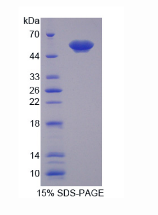 膜联蛋白A11(ANXA11)重组蛋白