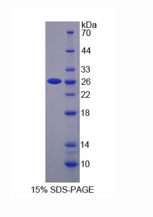 分拣连接蛋白17(SNX17)重组蛋白