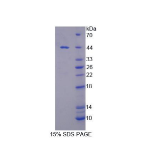 分拣连接蛋白9(SNX9)重组蛋白