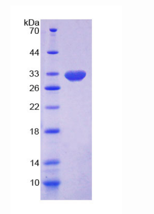 17-β-羟基类固醇脱氢酶14(HSD17b14)重组蛋白