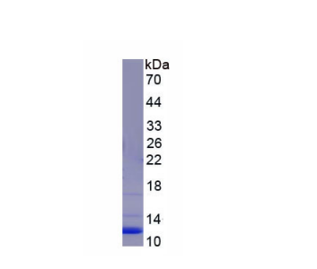 封闭蛋白3(CLDN3)重组蛋白