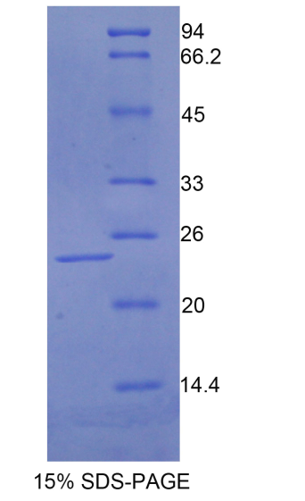 肉毒碱棕榈酰基转移酶1A(CPT1A)重组蛋白