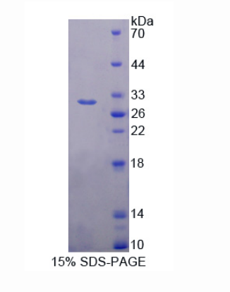双肾上腺皮质激素样激酶1(DCLK1)重组蛋白