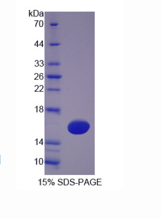 四旋蛋白1(TSPAN1)重组蛋白