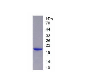 核纤层蛋白A/C(LMNA)重组蛋白