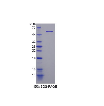 磷酸二酯酶4D(PDE4D)重组蛋白