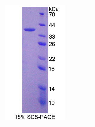 肽基精氨酸脱亚氨酶Ⅵ(PADI6)重组蛋白