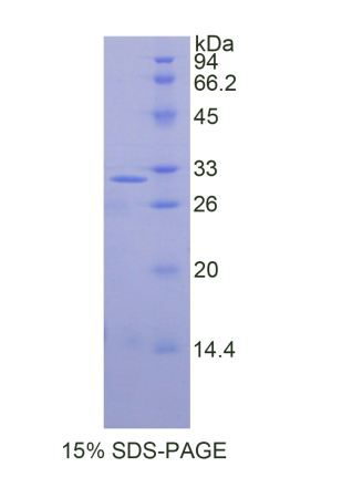胞裂蛋白5(SEPT5)重组蛋白