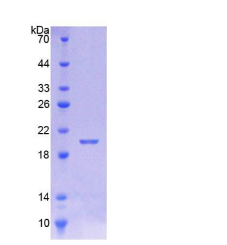 钙调蛋白样蛋白5(CALML5)重组蛋白