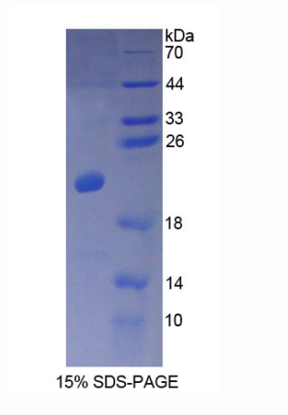 钙调蛋白样蛋白3(CALML3)重组蛋白