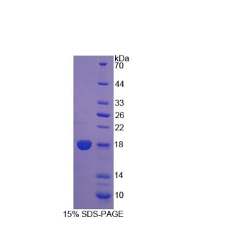 双特异性磷酸酶5(DUSP5)重组蛋白