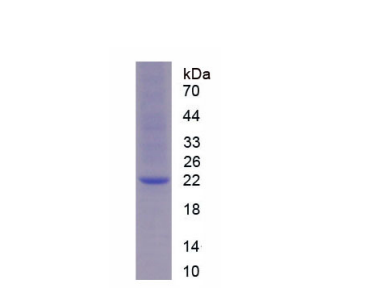 腺苷A2b受体(ADORA2b)重组蛋白