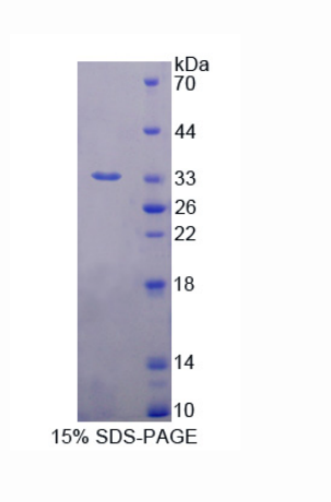 微管关联蛋白RP/EB家族成员1(MAPRE1)重组蛋白