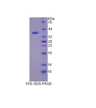 分泌球蛋白家族2A成员2(SCGB2A2)重组蛋白