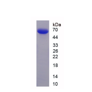 溶血卵磷脂酰基转移酶2(LPCAT2)重组蛋白