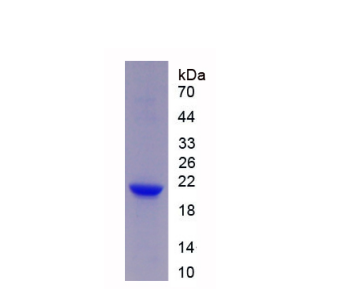 髓细胞触发受体2(TREM2)重组蛋白