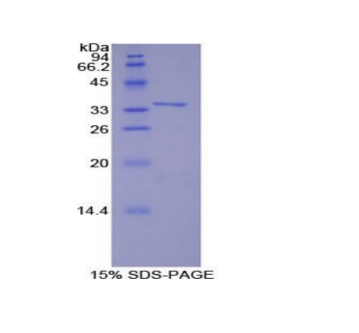 TNF受体关联因子6(TRAF6)重组蛋白