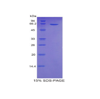 硫酸酯酶2(SULF2)重组蛋白
