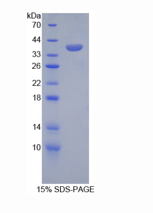 丝氨酸肽酶抑制因子Kazal型1(SPINK1)重组蛋白