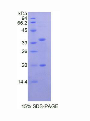 丝氨酸肽酶抑制因子Kazal型5(SPINK5)重组蛋白