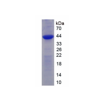 受体活性修饰蛋白2(RAMP2)重组蛋白