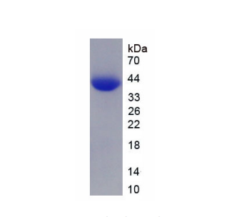 神经源性分化蛋白6(NEUROD6)重组蛋白