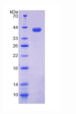 核小体装配蛋白1样1(NAP1L1)重组蛋白