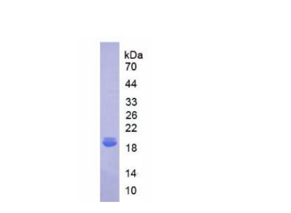 白介素18结合蛋白(IL18BP)重组蛋白