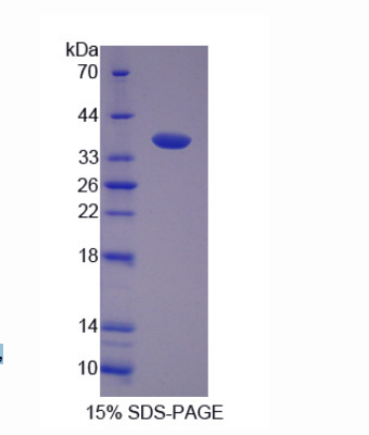 F-框亮氨酸丰富重复蛋白3(FBXL3)重组蛋白