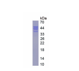 DNA甲基转移酶3B(DNMT3B)重组蛋白