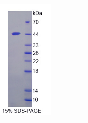 Bcl2/腺病毒E1B