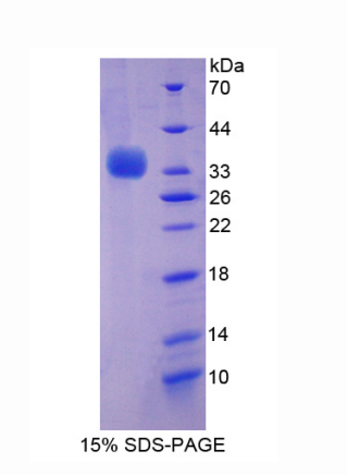 苄氯素1(BECN1)重组蛋白