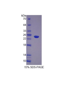 Abl交互子1(ABI1)重组蛋白