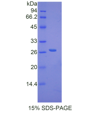 DNA修复蛋白RAD50(RAD50)重组蛋白