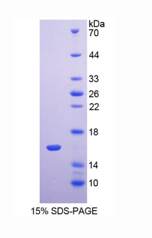跨膜蛋白27(TMEM27)重组蛋白