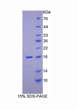 视黄醇结合蛋白2(RBP2)重组蛋白