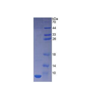 胸腺素β4(TMSB4X)重组蛋白