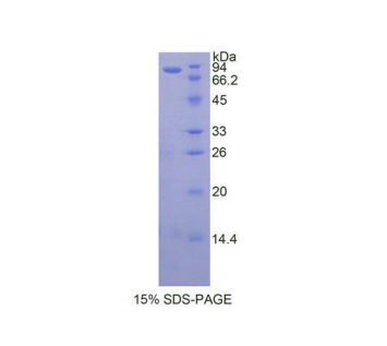 90kDa热休克蛋白αB1(HSP90aB1)重组蛋白