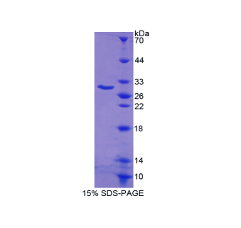 B-细胞淋巴瘤因子2样蛋白(Bcl2L)重组蛋白
