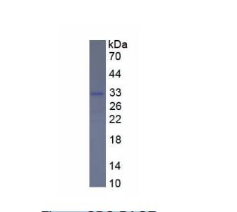 FK506结合蛋白8(FKBP8)重组蛋白